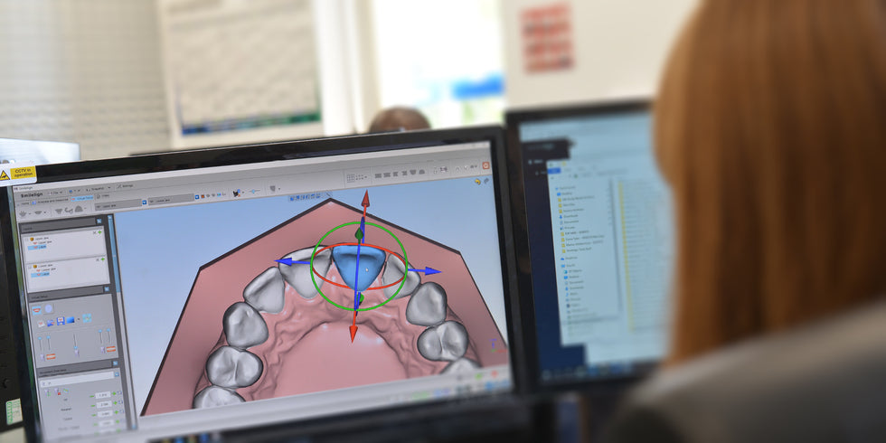 Send us a case – S4S Dental