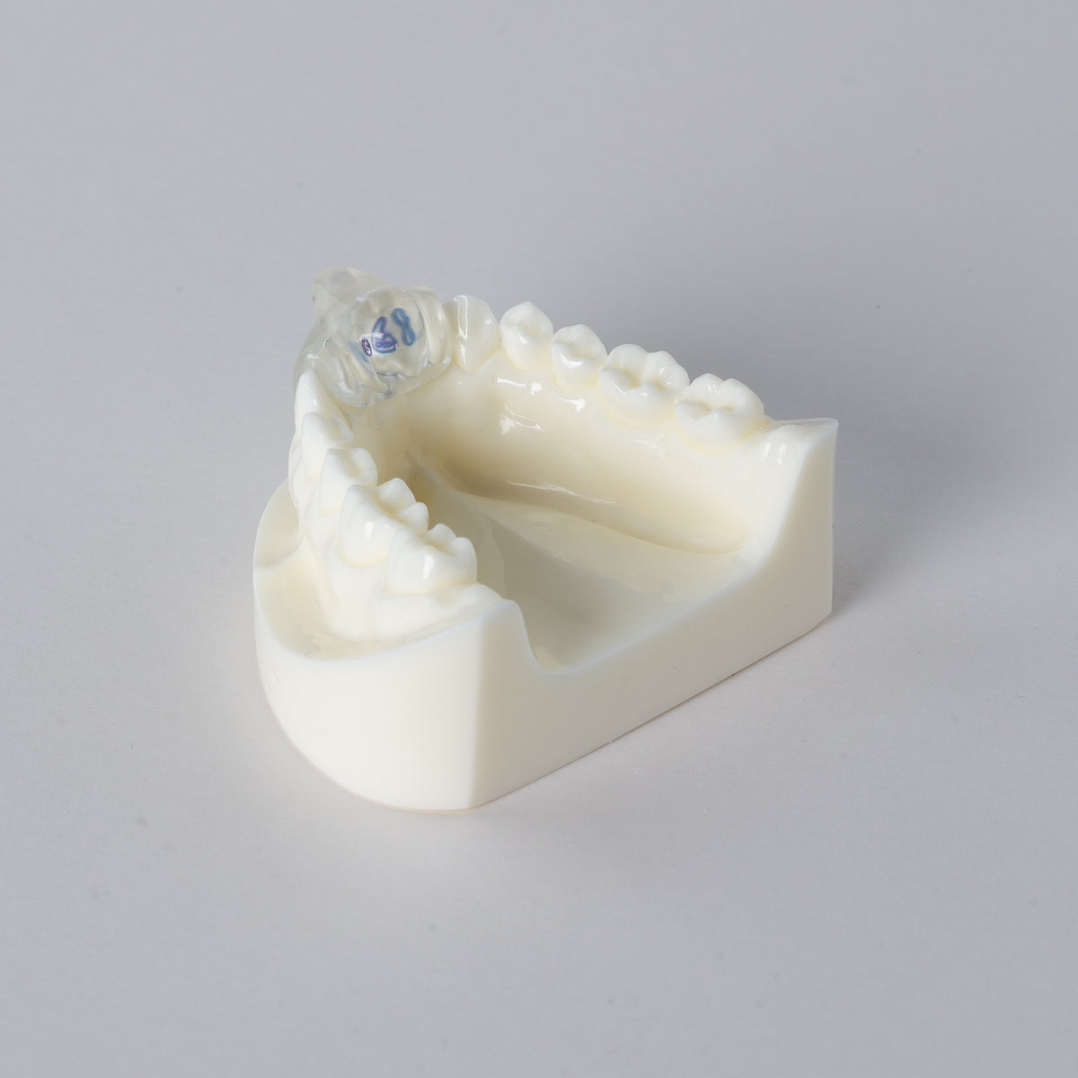Parafunction Bruxism & Parafunction – S4S Dental